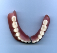 Prothesenbruch